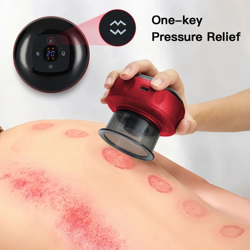 Smart Cupping Therapy Massager with Red Light Therapy, Hijama Massager